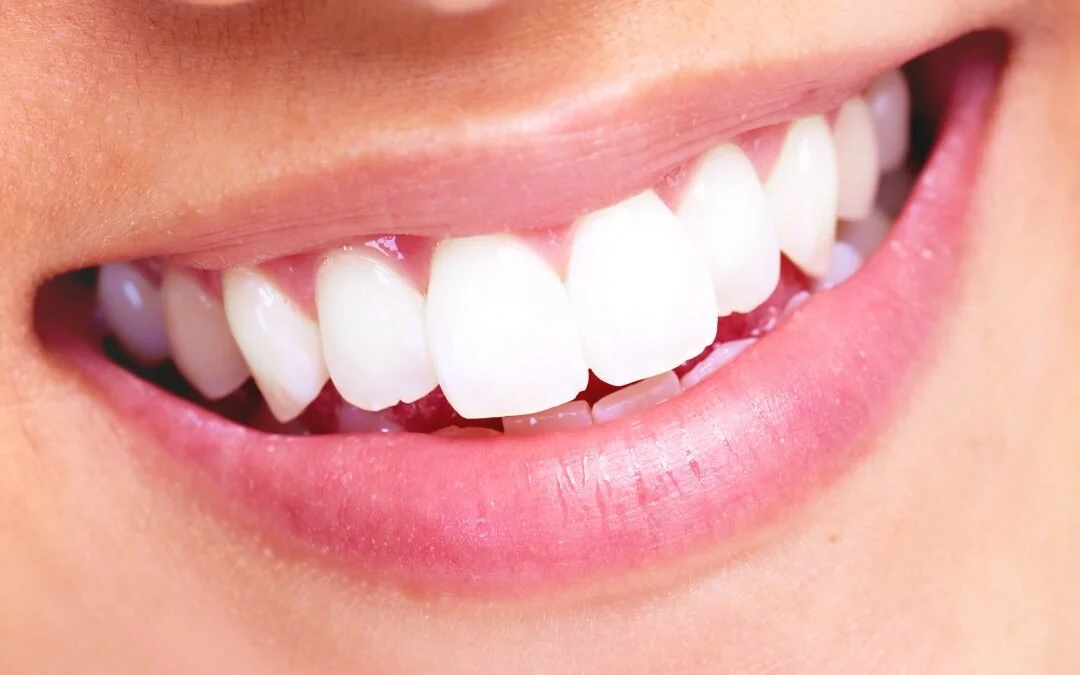 Finding the Best Teeth Whitening Dentist is Easier than You Think