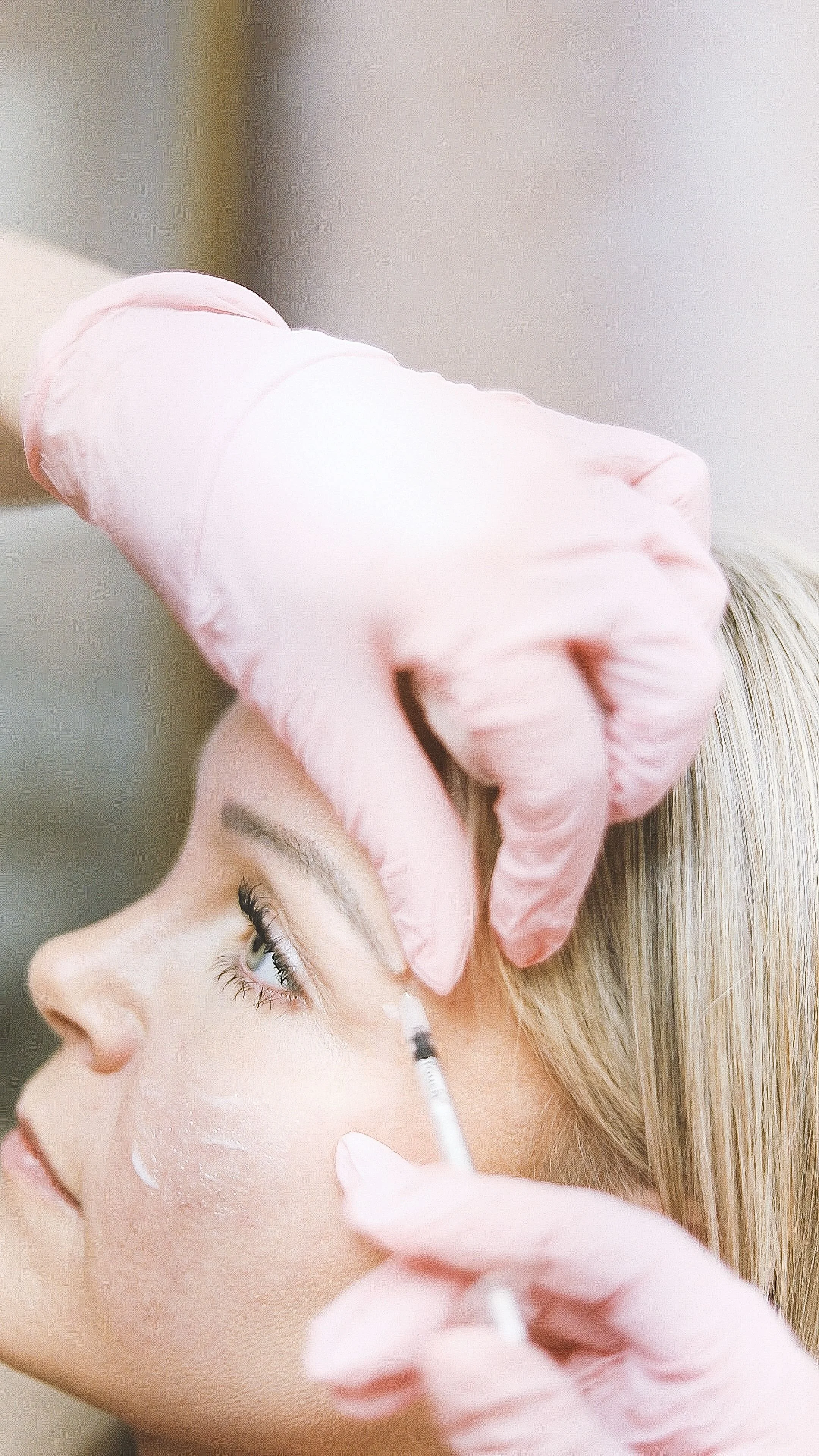 Why Sculptra Is Popular for Natural-Looking Facial Rejuvenation