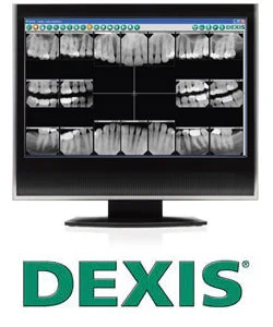 We proudly offer DEXIS digital x-rays, 90% less radiation.