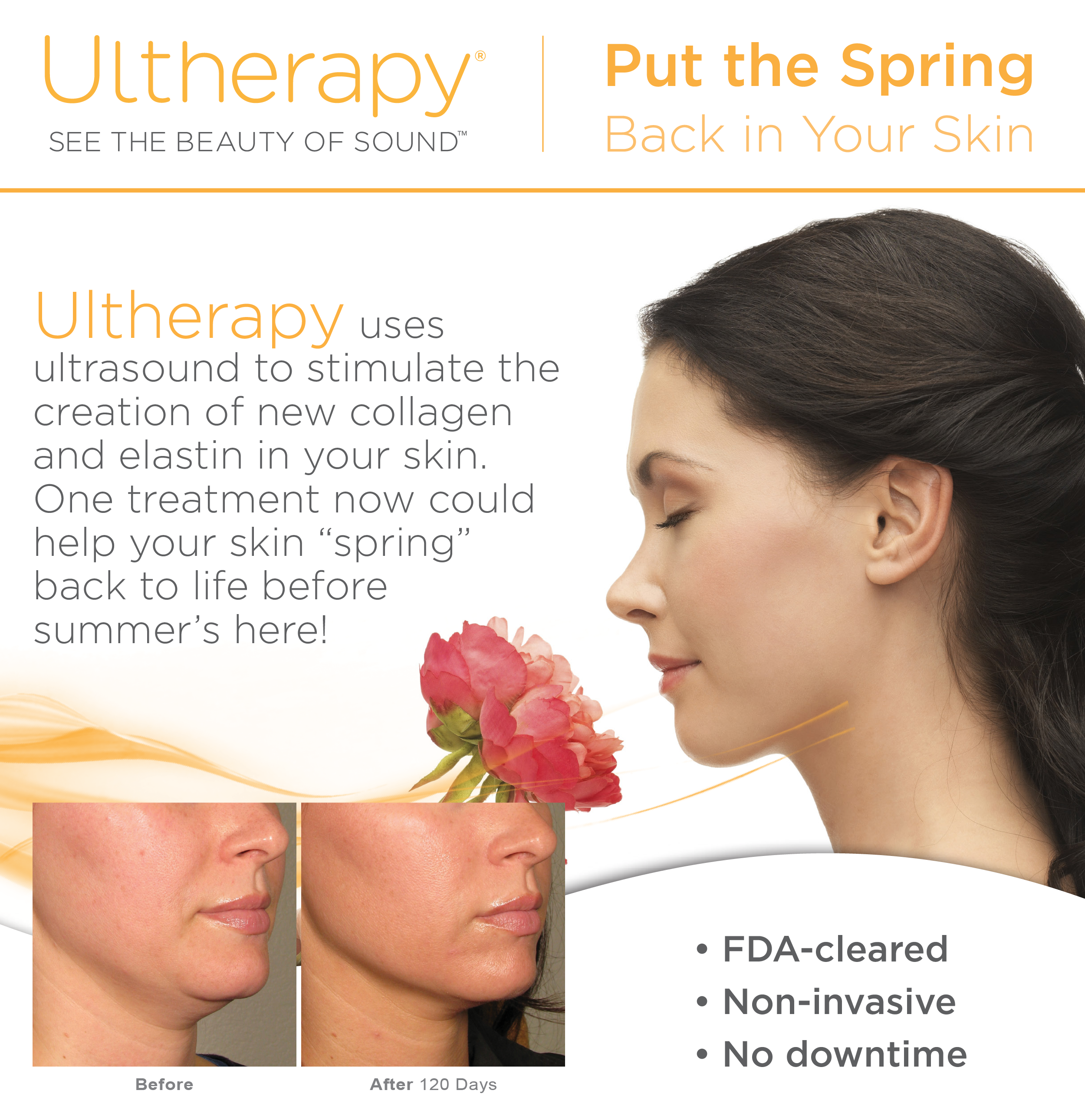 Are You Ready to Look Younger? Spring Savings on Ultherapy