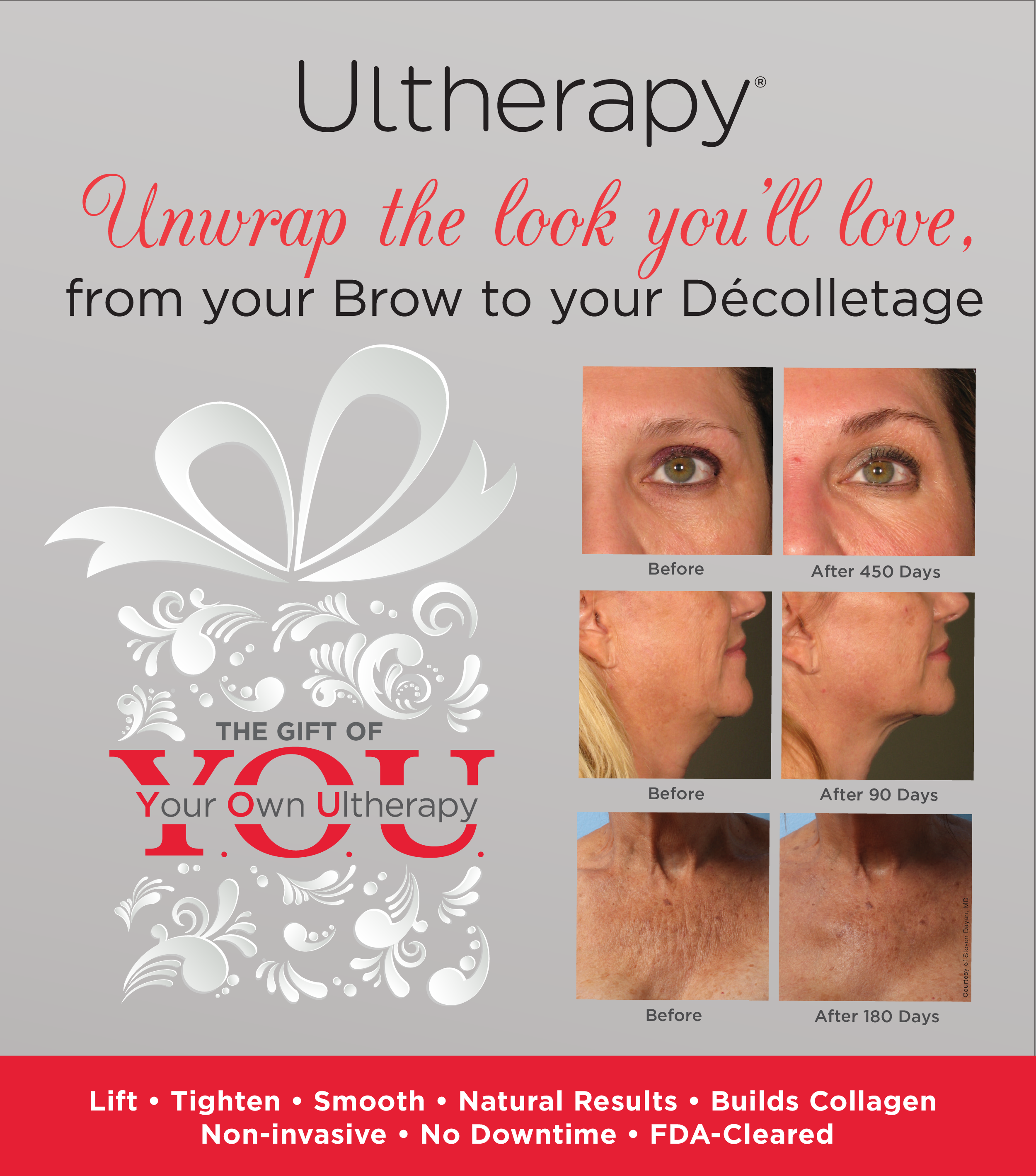 Unwrap Ultherapy