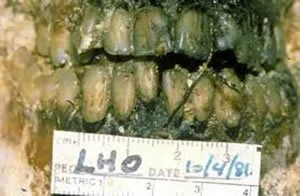 oswald-teeth.jpg