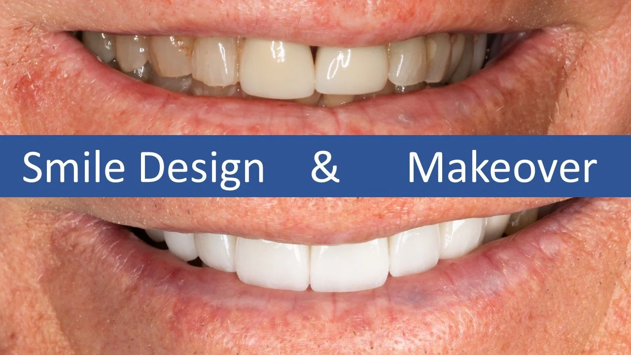 Smile Design and Makeover.jpg