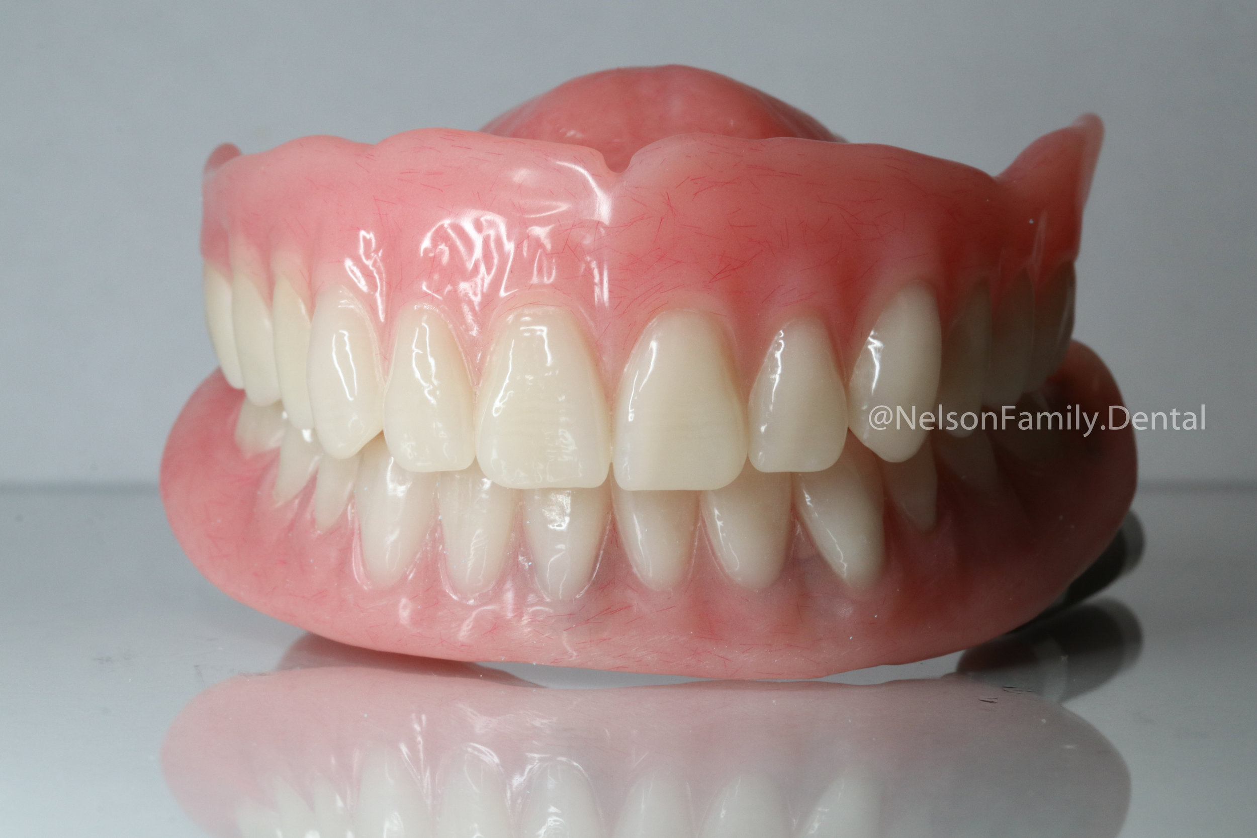 Implant-Denture-Vita-Teeth-5883.jpg