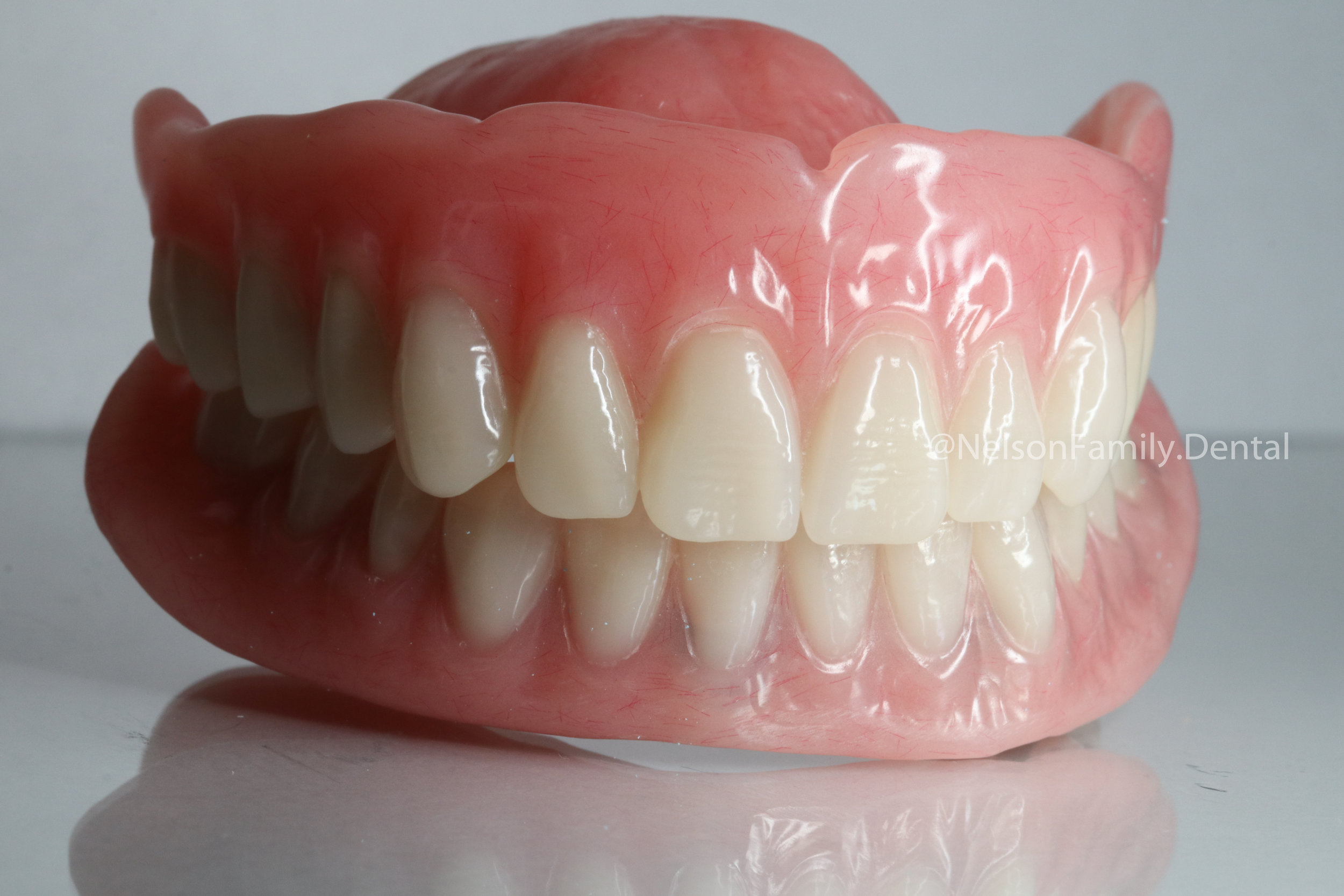 Implant-Denture-Vita-Teeth-5887.jpg