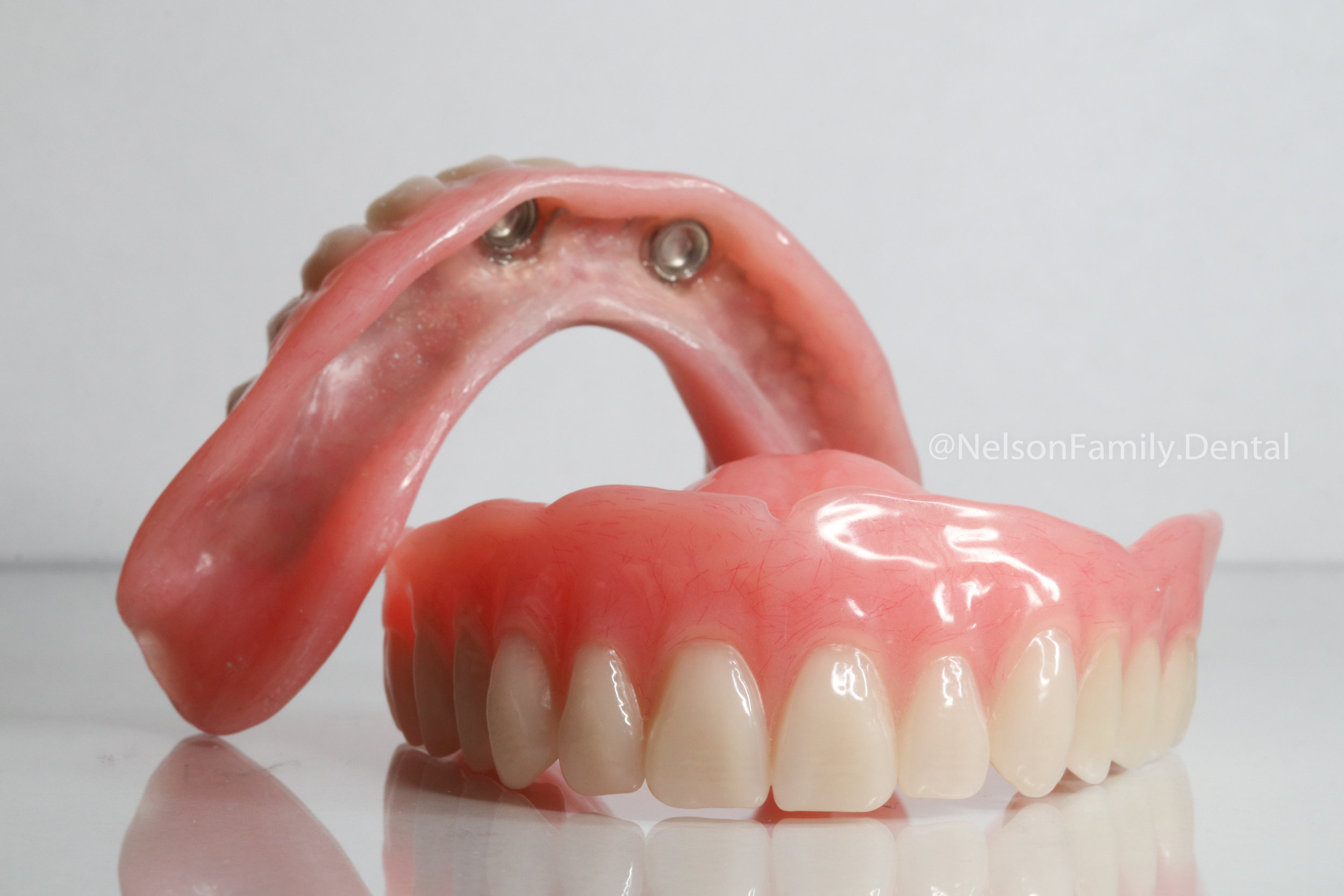 Implant-Denture-Vita-Teeth-5890.jpg