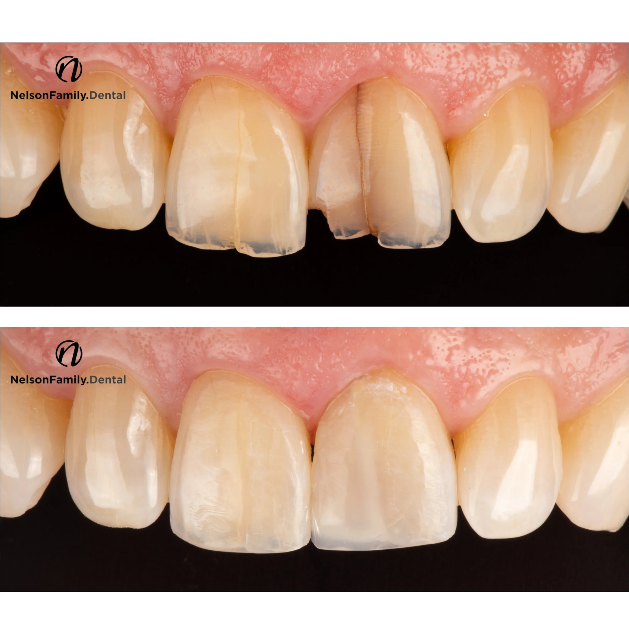 Stained Fracture Lines 8 and 9 before and after.jpg
