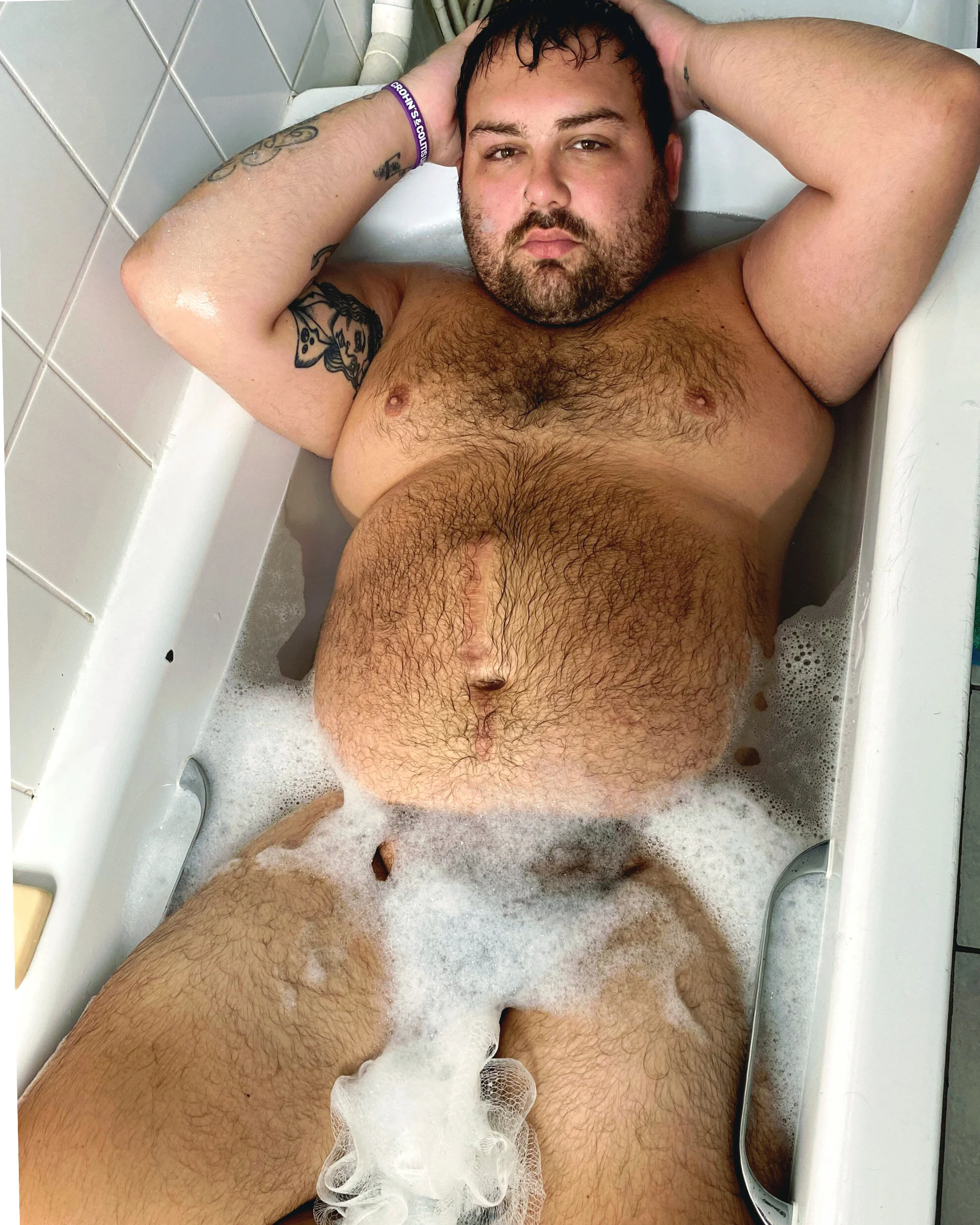  Perry Barrellie   I love my body and skin I’m in, the scar tells a story of my journey with Crohn’s Disease, don’t be ashamed of your story it will help others.  