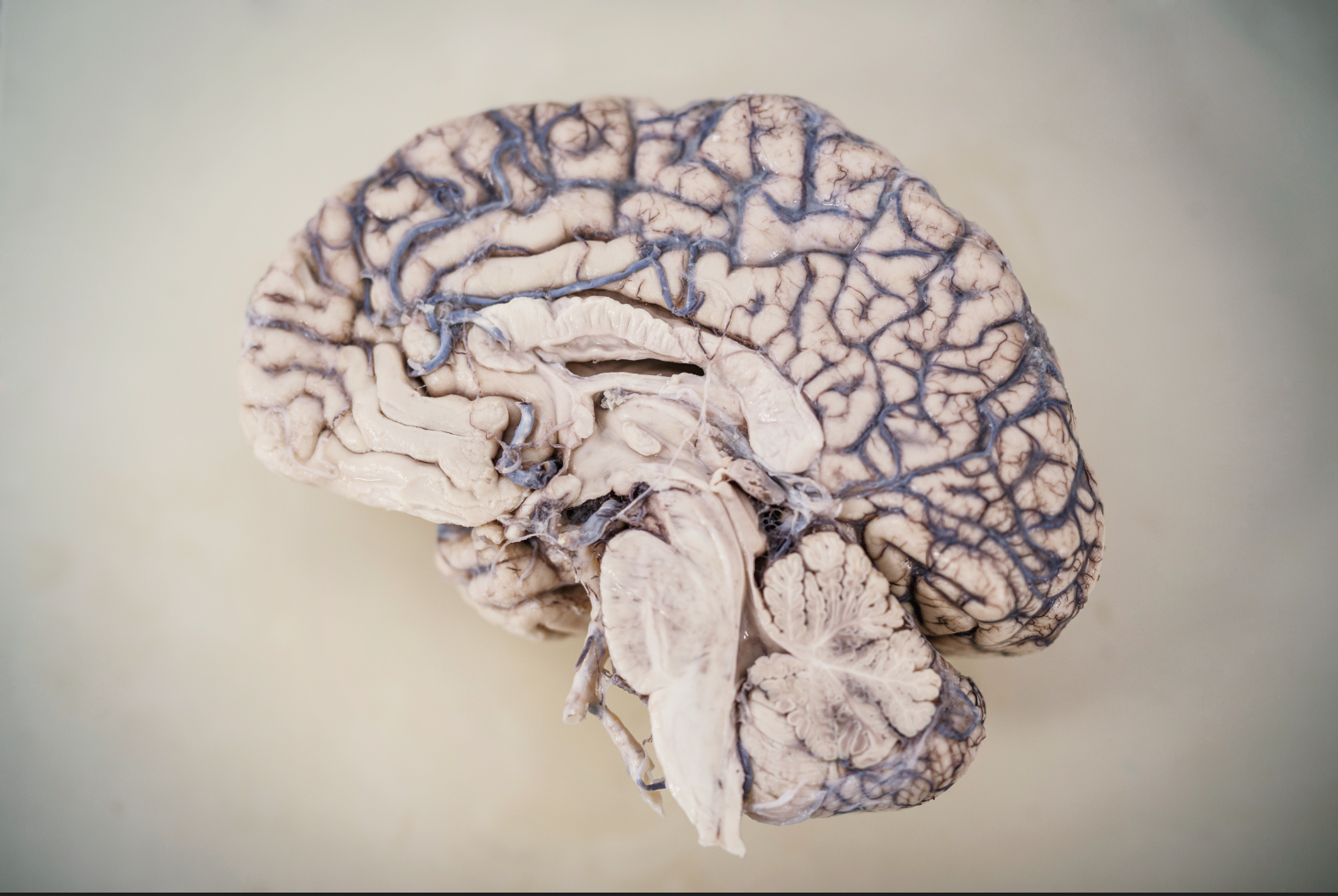 Brain Bank