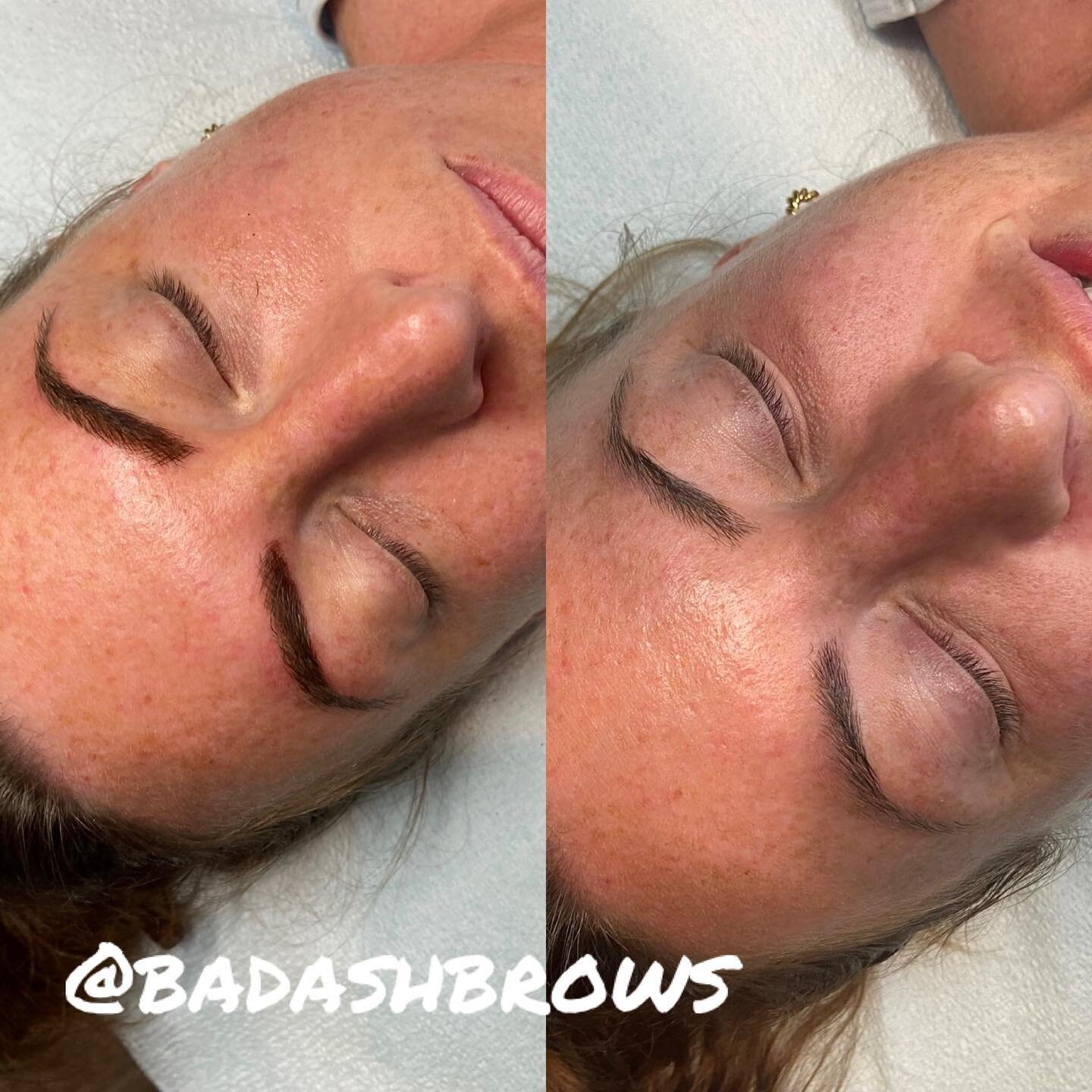 This Beauty already had amazing brows. She just wanted them sightly more defined and a little more density. The redness will subside as they heal. I can&rsquo;t wait until the touch up to see them! 
.
.
.
#browsonpoint #bladenshade #microblading #rev