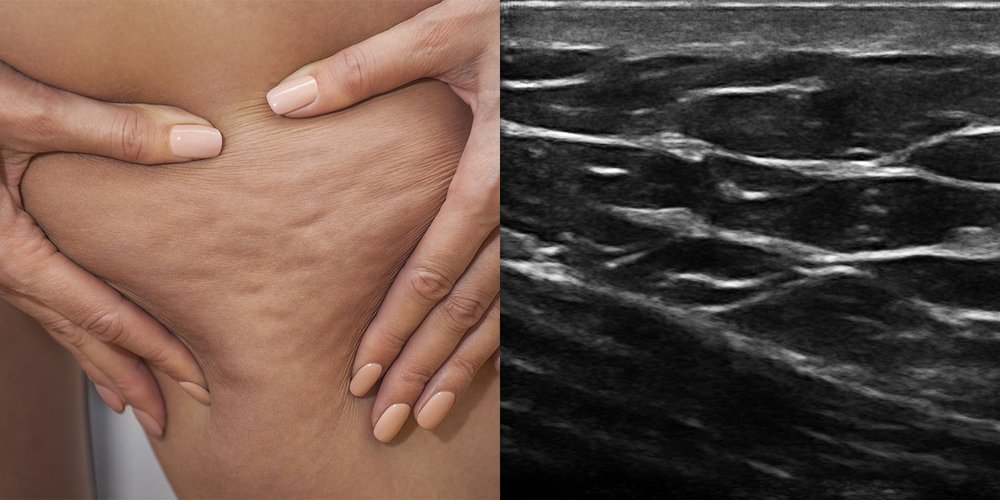 Exclusive to us, skin ultrasonography, for a truly personalised treatment