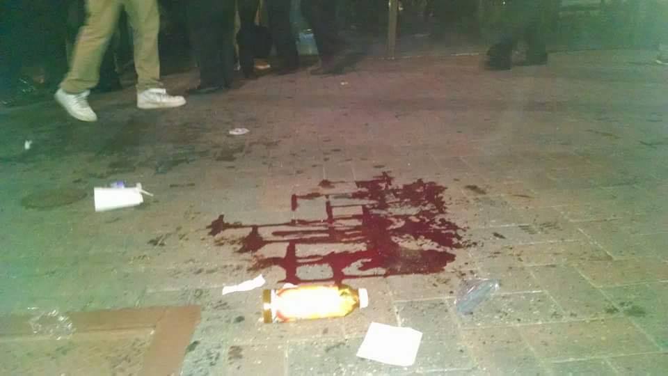 This is the spot where a protestor was shot in Charlotte at close range by police. What I heard last was that this man was in critical condition. Witnesses reported the use of rubber bullets, which FYI, are not solid rubber. They have a metal core. They are meant to hurt, often injure, and at close range, they can kill.