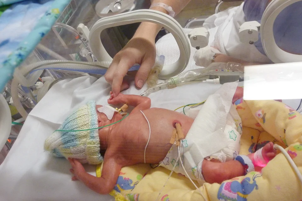 Adison's Birth Story