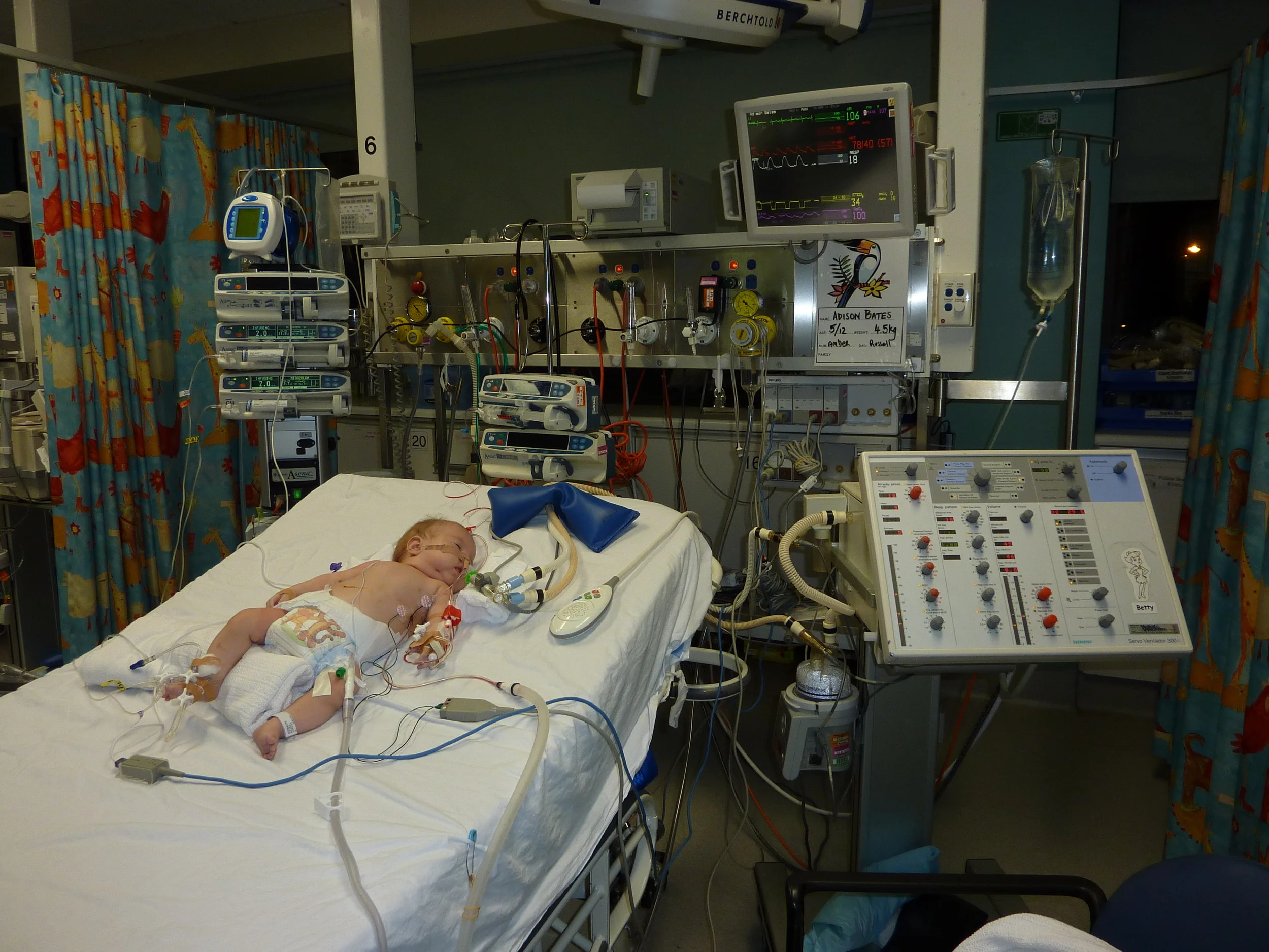 Post op in PICU. I had a mild irrational panic when i saw him, my baby, on a big bed, with no side rails. He was heavily sedated and not going anywhere!