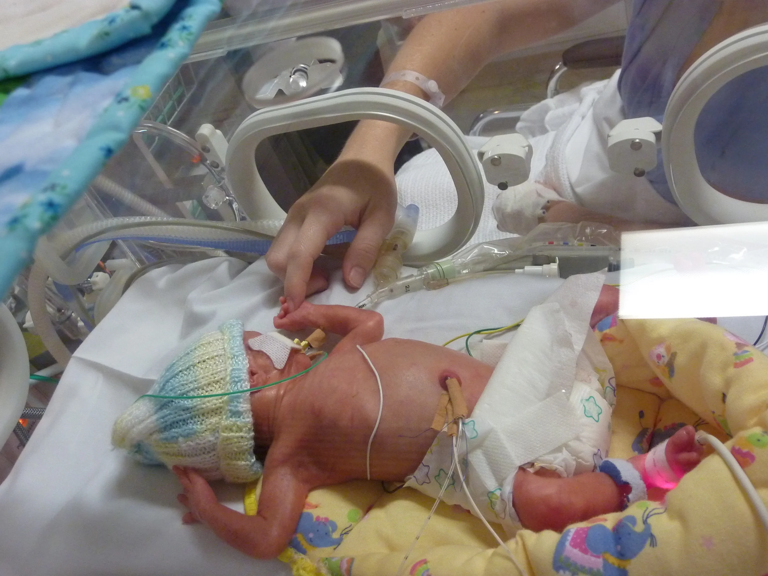 Adison's Birth Story