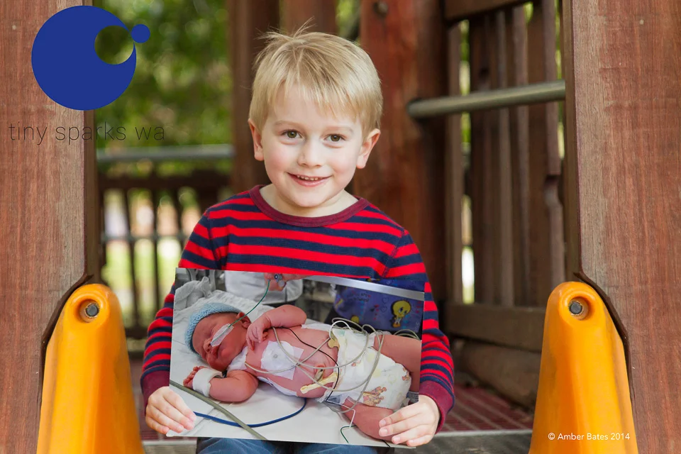Noah born at term with a complete heart block requiring admission to NICU and fitting of a pacemaker.