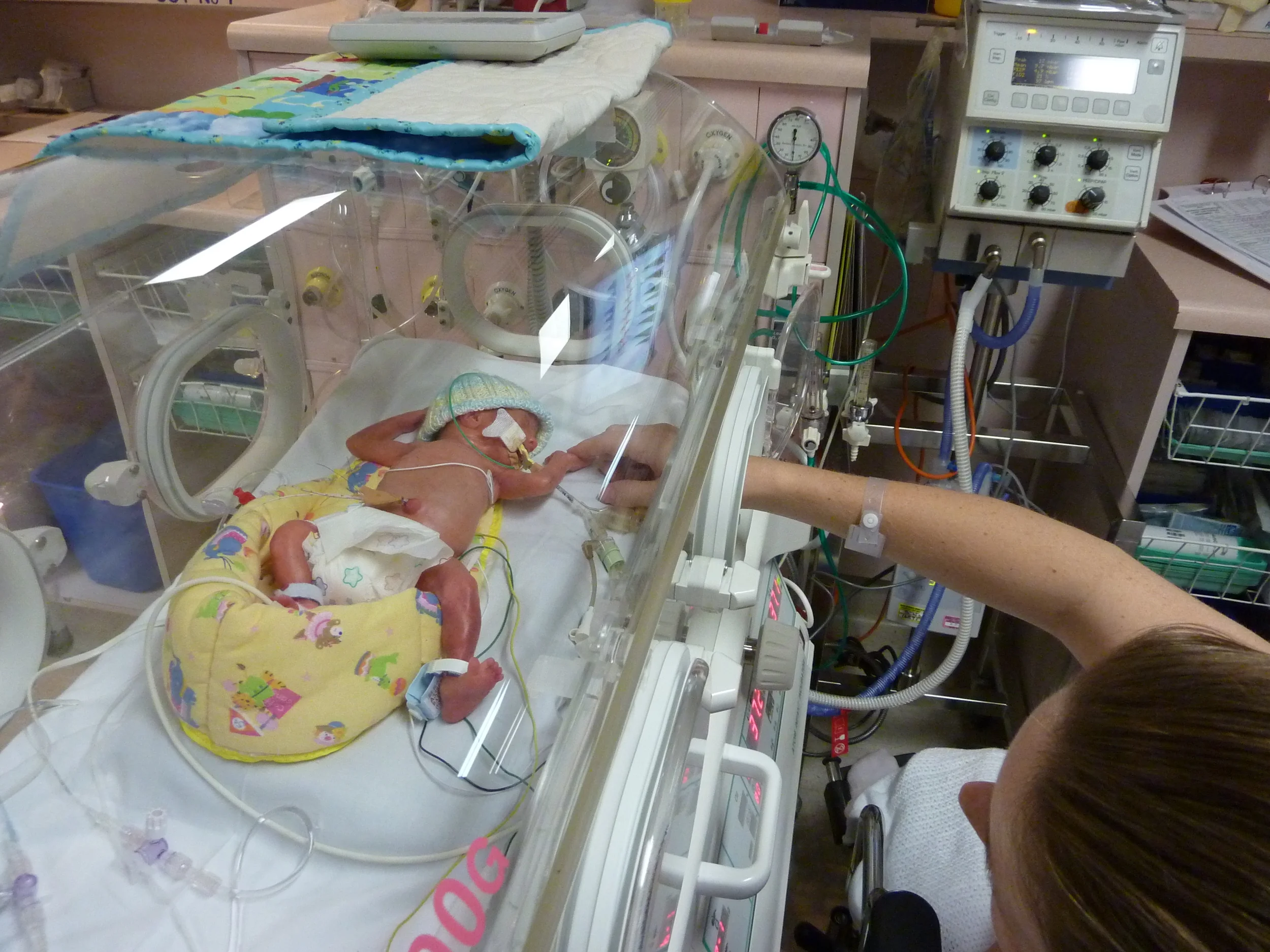 Adison's NICU Journey - Up close and personal