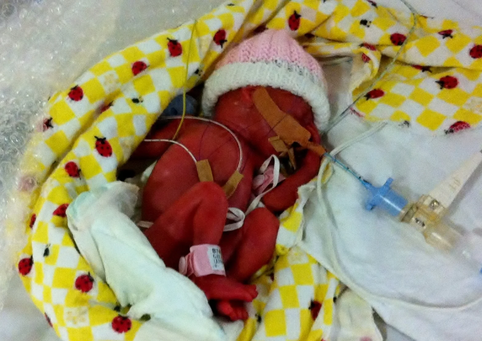 "Code Blue" Olivia's Birth Story