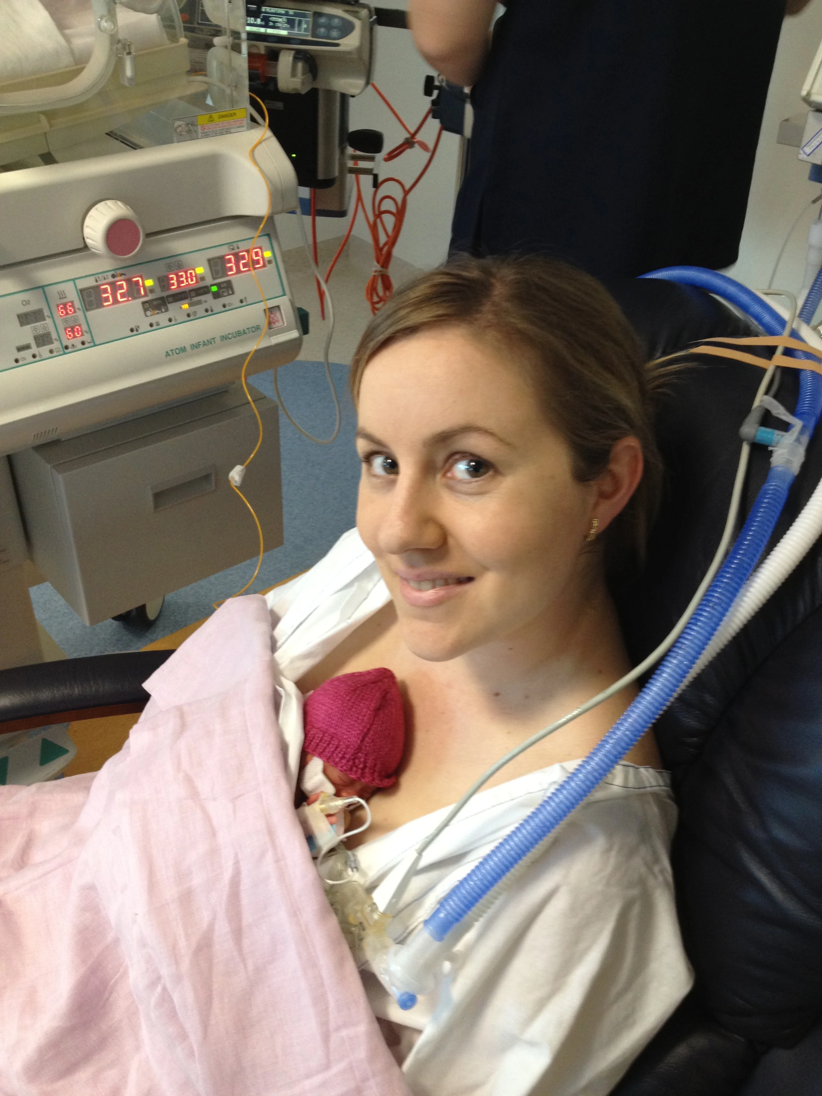 Her Battle Begins – Olivia’s Story (The first three weeks of NICU)