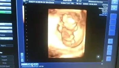 Amelia at 12 weeks gestation - this was video footage and she was really moving! We called her our little tiny dancer :-)