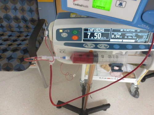 A very small blood transfusion for a premature baby