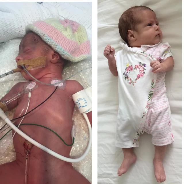 Penelope at birth and due date 