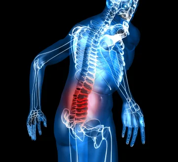 Bad Back?