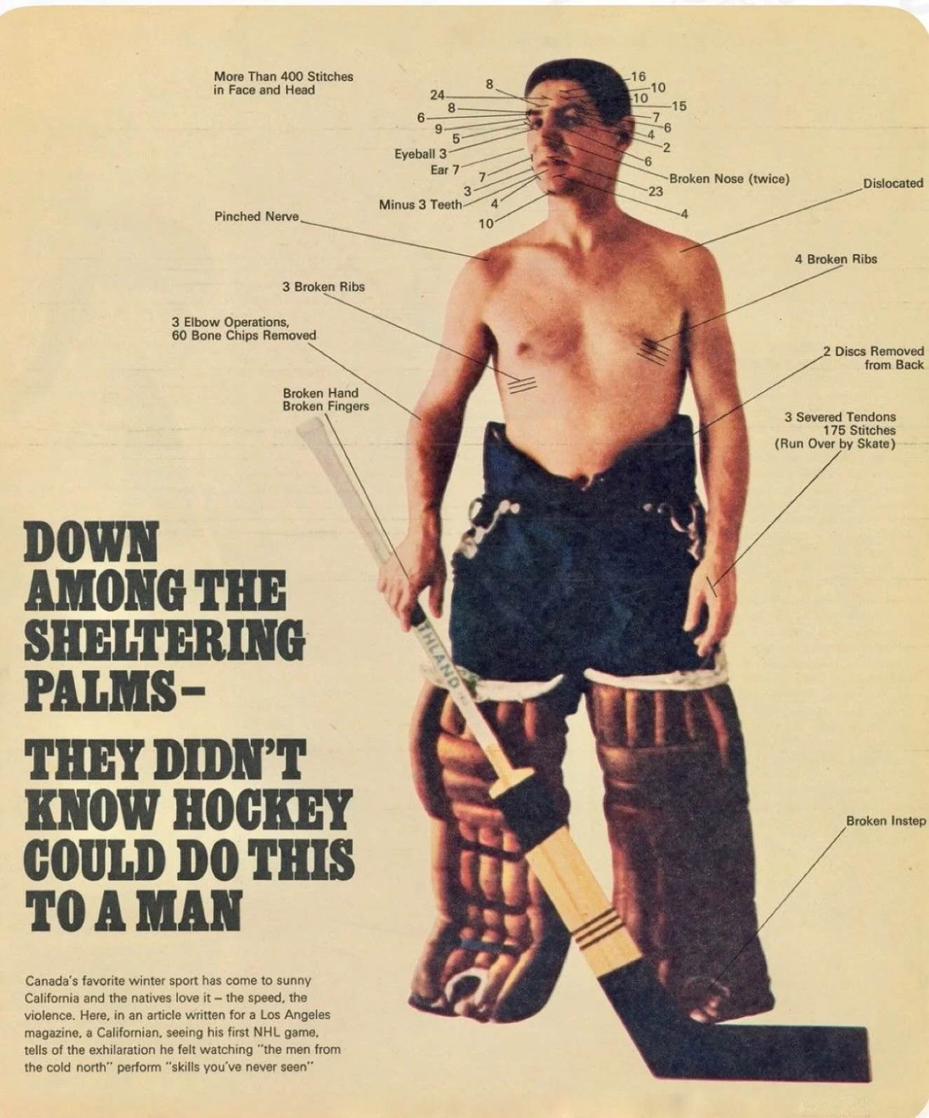 Catcher&rsquo;s equipment is often referred to as &ldquo;tools of ignorance&rdquo; but the same can be said of goalie gear. Not many of the OGs had straight fingers or noses. #vintagehockey #goalies #realmen