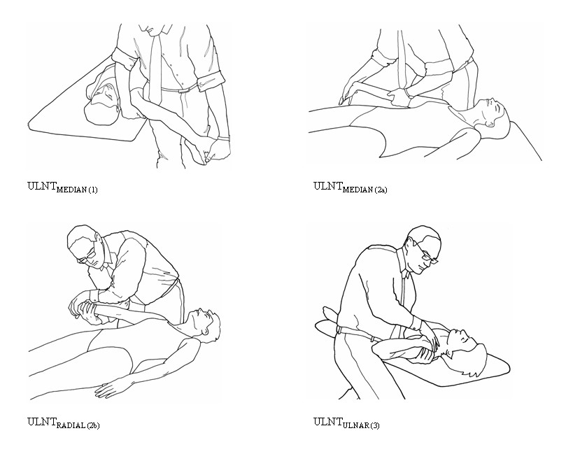 Butler DS, The Sensitive Nervous System, Unley, DC, Australia: NOIgroup Publications, 2000