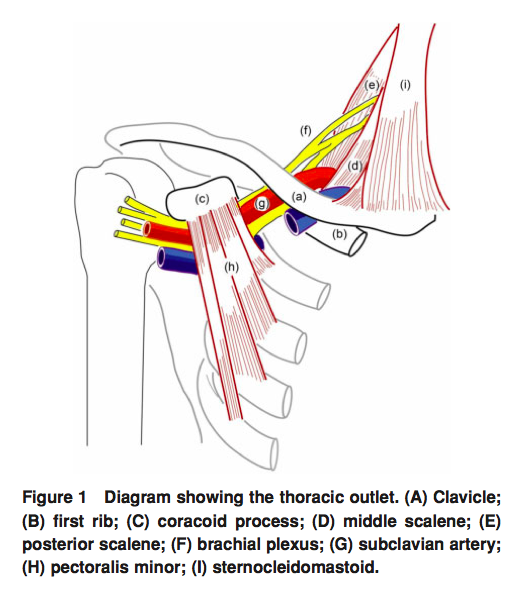Neurodynamic treatments for Thoracic Outlet Syndrome — Rayner & Smale
