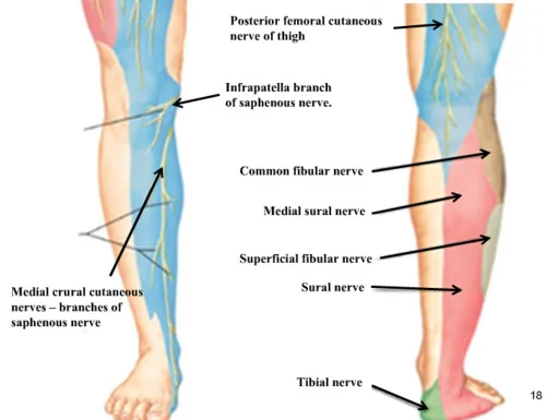 Infrapatella Branch of Saphenous Nerve, location of Marnie's neural irritation (image courtesy of google.com)