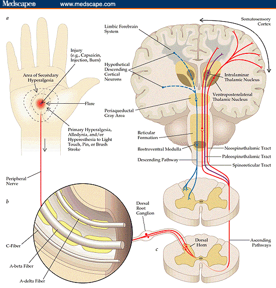 The mechanisms of pain (Courtesy of Medscape http://www.medscape.org/viewarticle/446350_3). 