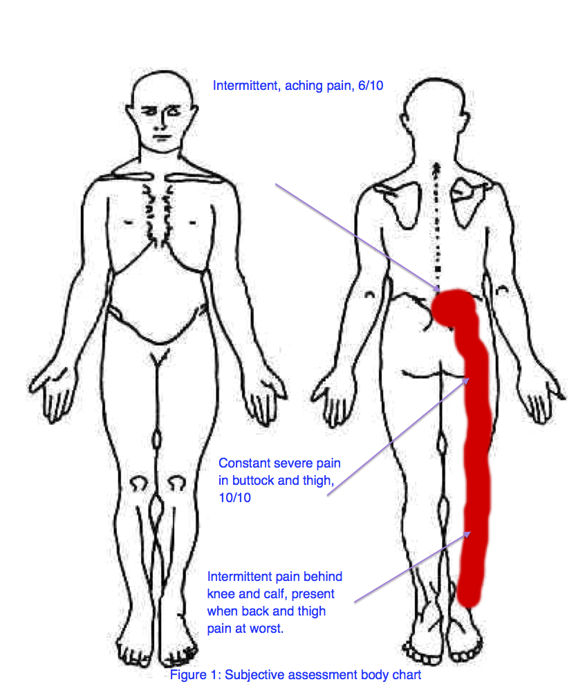 Body Chart Physical Therapy