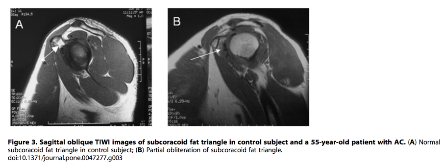 (Zhoa, et al., 2012, p. 4)