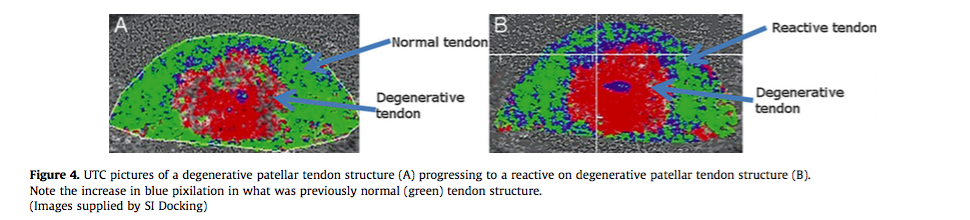 This is what ultrasound looks like (Rudavsky & Cook; 2014., p. 126)