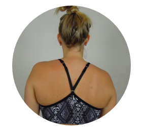The role of the scapula in shoulder impingement: Part 2