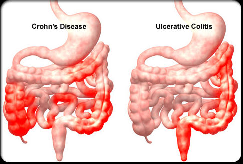 Image courtesy of Google Images, retrieved March 30th, 2016.