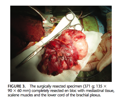 (Dartnell, et al., 2009, p. 137)