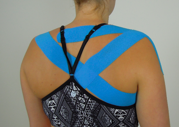 Taping scapula upward rotation, elevation & posterior tilt