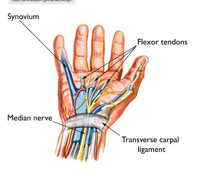 Carpal tunnel syndrome — Rayner & Smale