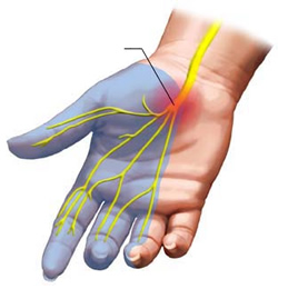 Image courtesy of Google Images