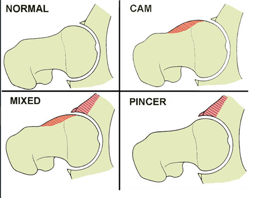 Image courtesy of Google Images