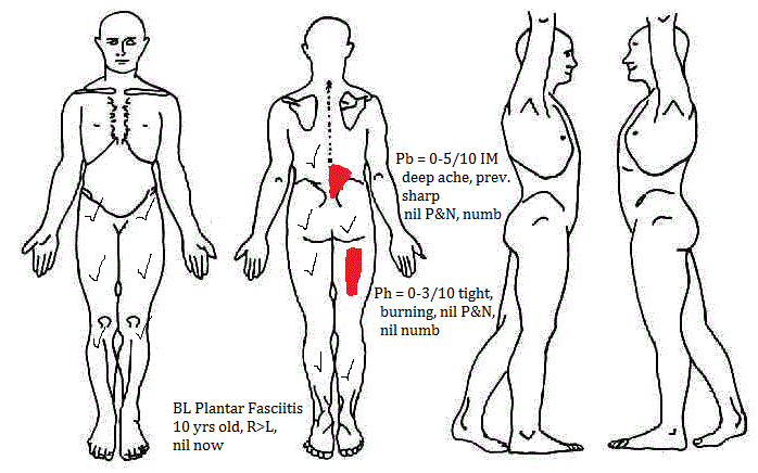 Body Chart Physical Therapy