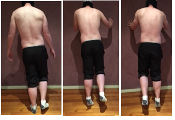 Pic 1&amp;2: Left leg single leg calf raise &nbsp;Picture 3: R SLCR