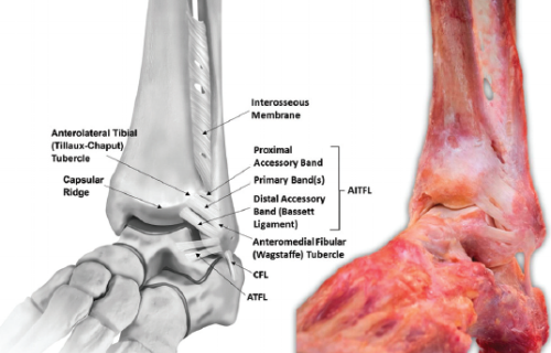Anterior Tibiofibular Ligament – GDXGQ