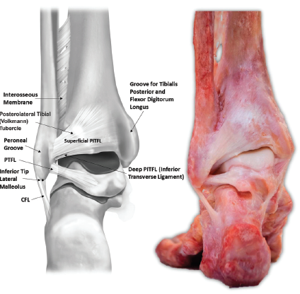 Picture 4. Posterior view of ankle (Williams 2015, pg 94).