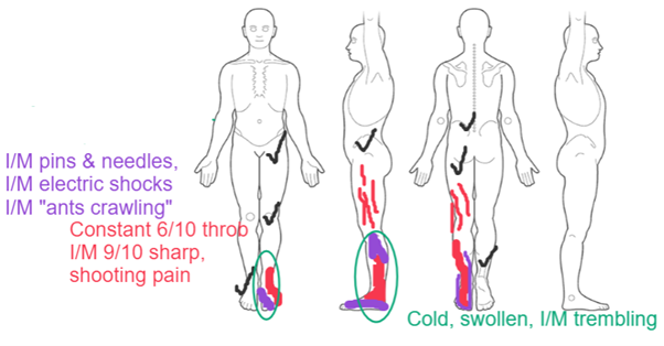 Figure 1. Body Chart at Initial Assessment.