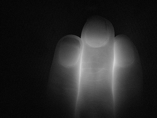 THREE FINGERS BY TIA_INSPIRATIVA CREATIVE COMMONSFLICKR.COM