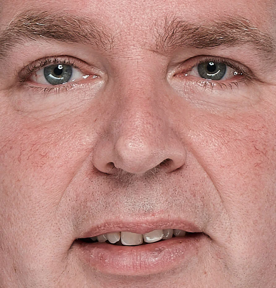 Het effect van de Eye-Lighter in de ogen