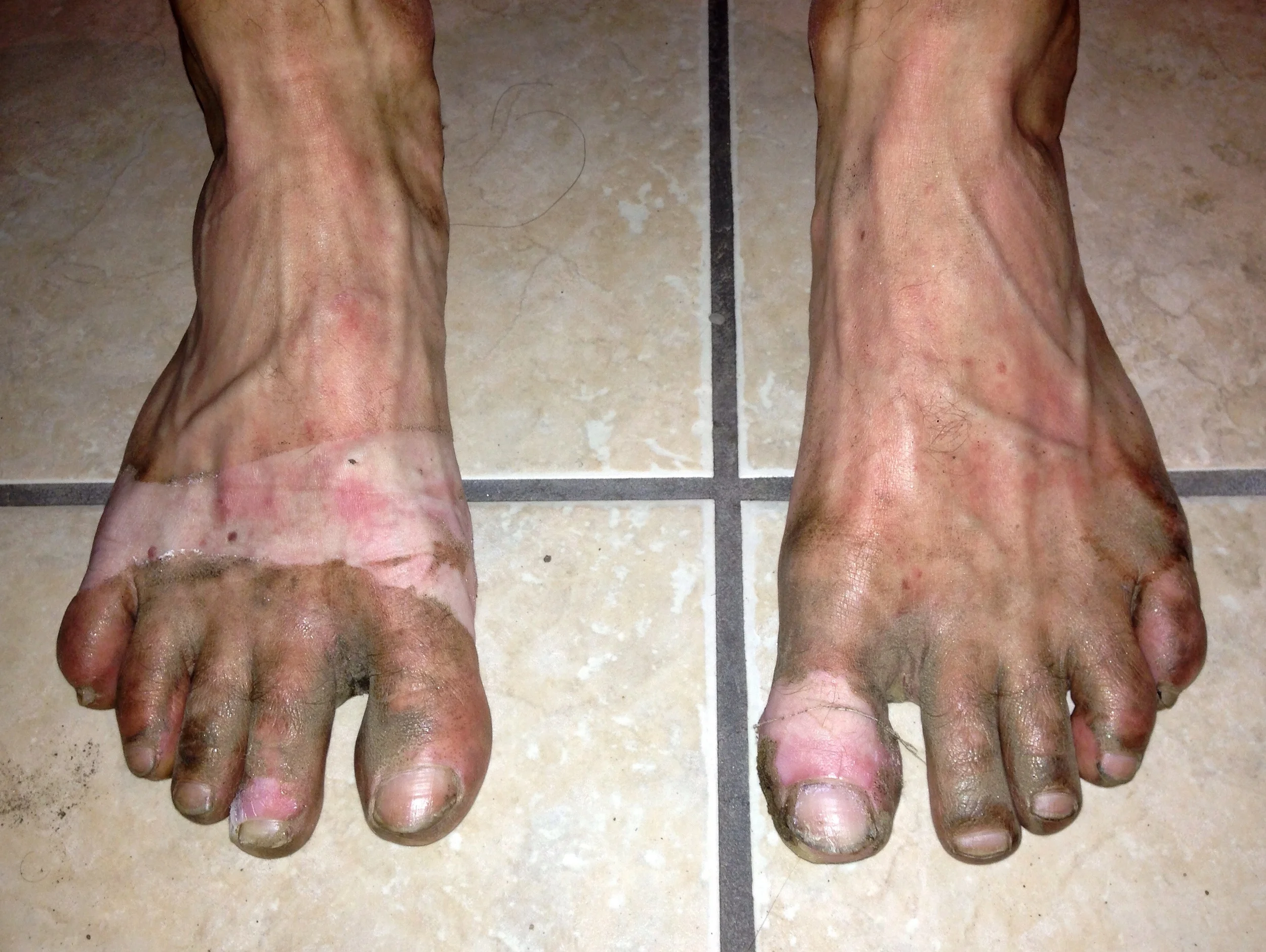 My feet at the end of the day.